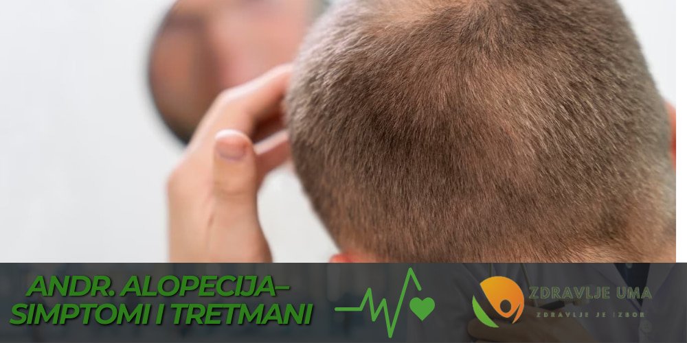 Androgena Alopecija iskustva korisnika
