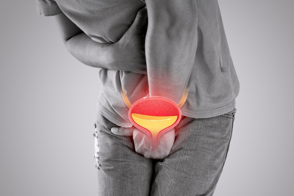 Kako liječiti vanjske hemoroide