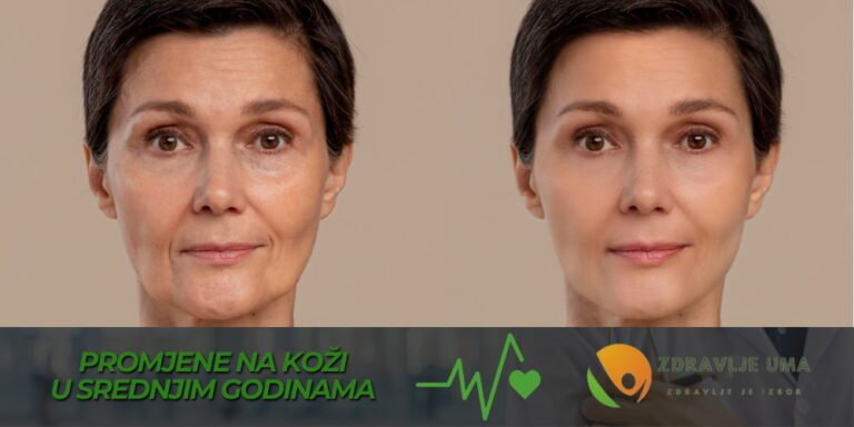 Promjene u koži nakon 35. godine i kako ih ublažiti