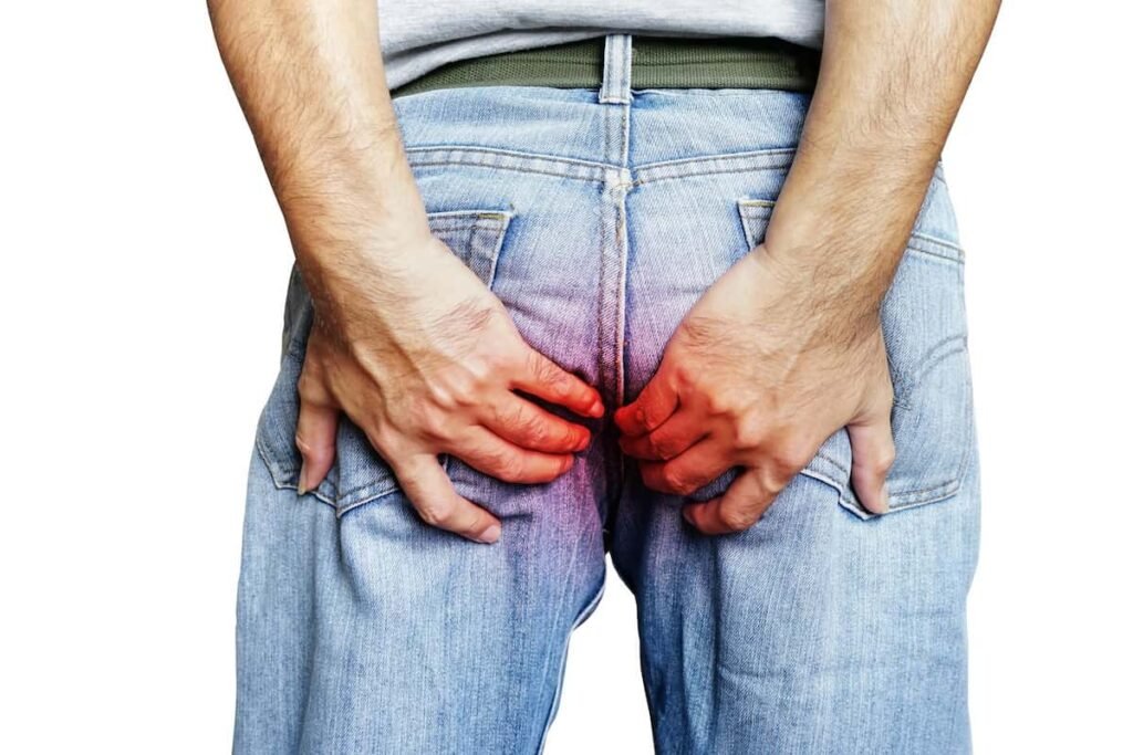 Definicija unutrašnjih hemoroida